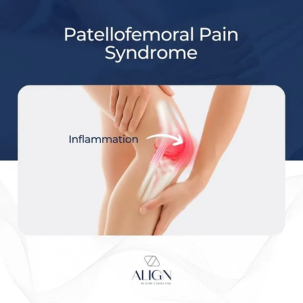 What is Patellofemoral Pain Syndrome (Runner's Knee)?