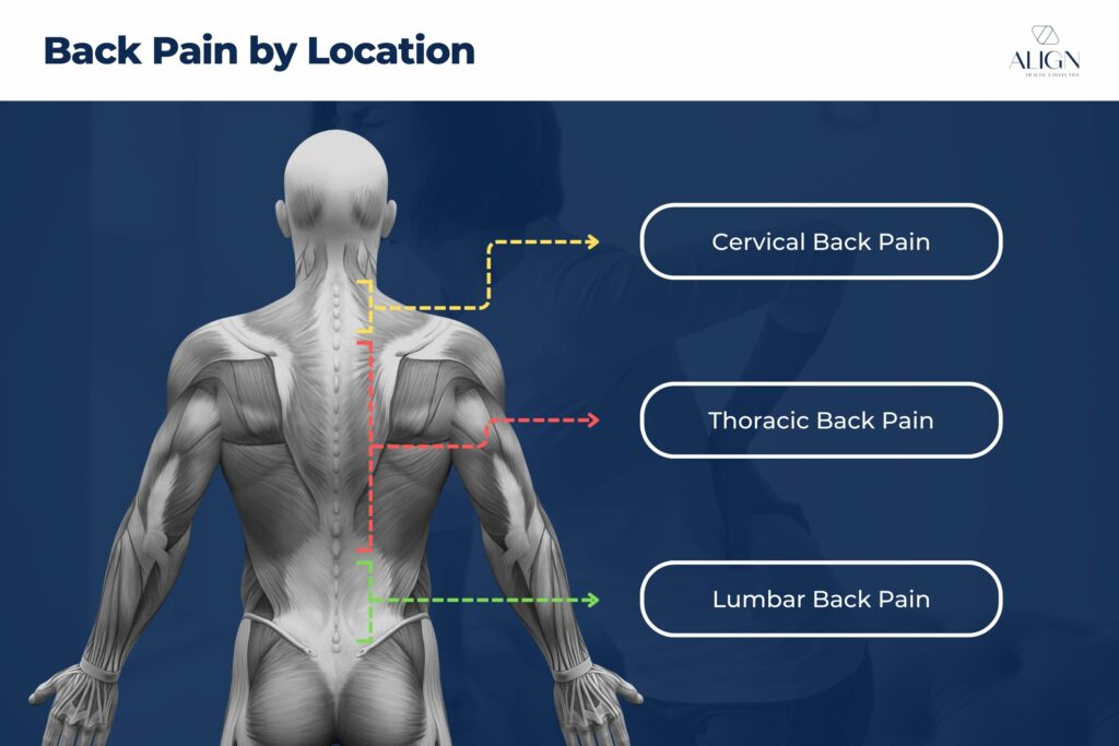 Different Types of Back Pain by Location